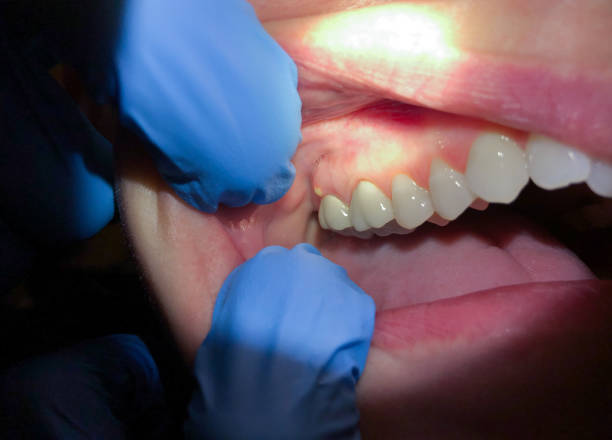 Best Emergency TMJ Treatment in Hawkinsville, GA