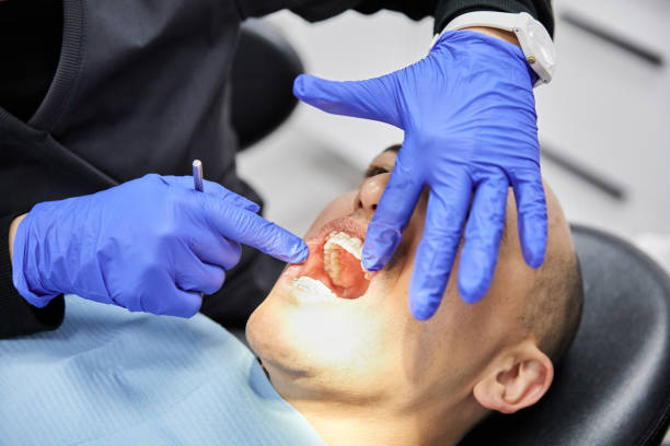 Best Emergency Dental Care for Broken or Chipped Teeth in Hawkinsville, GA